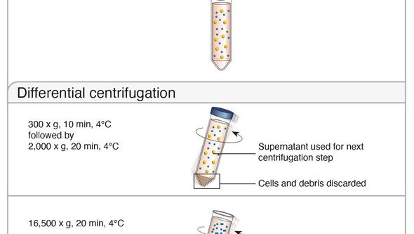 Figure 1. Overview of the isolation procedure for tissue-derived EVs.
